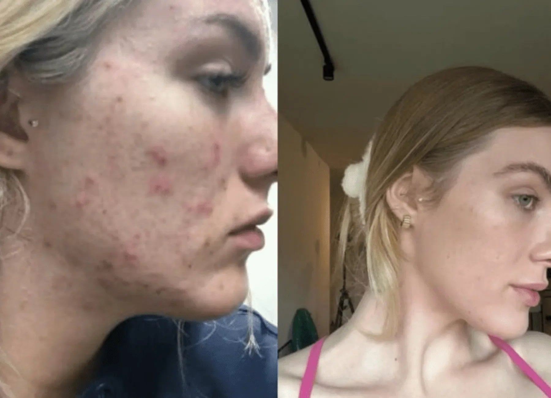 Transform Your Skin With Cellstory
